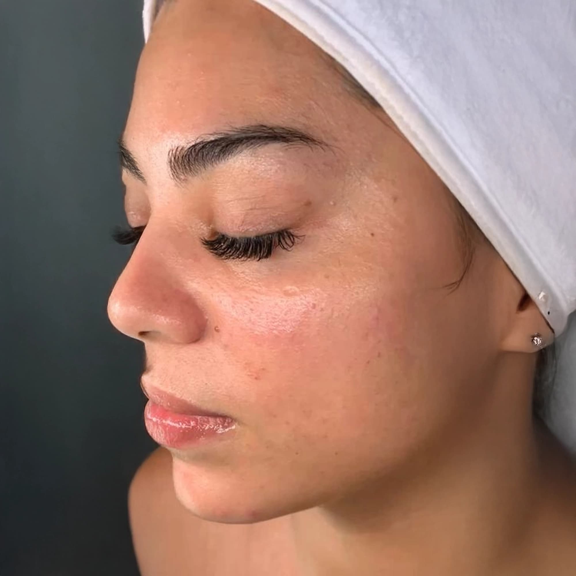 Before treatment